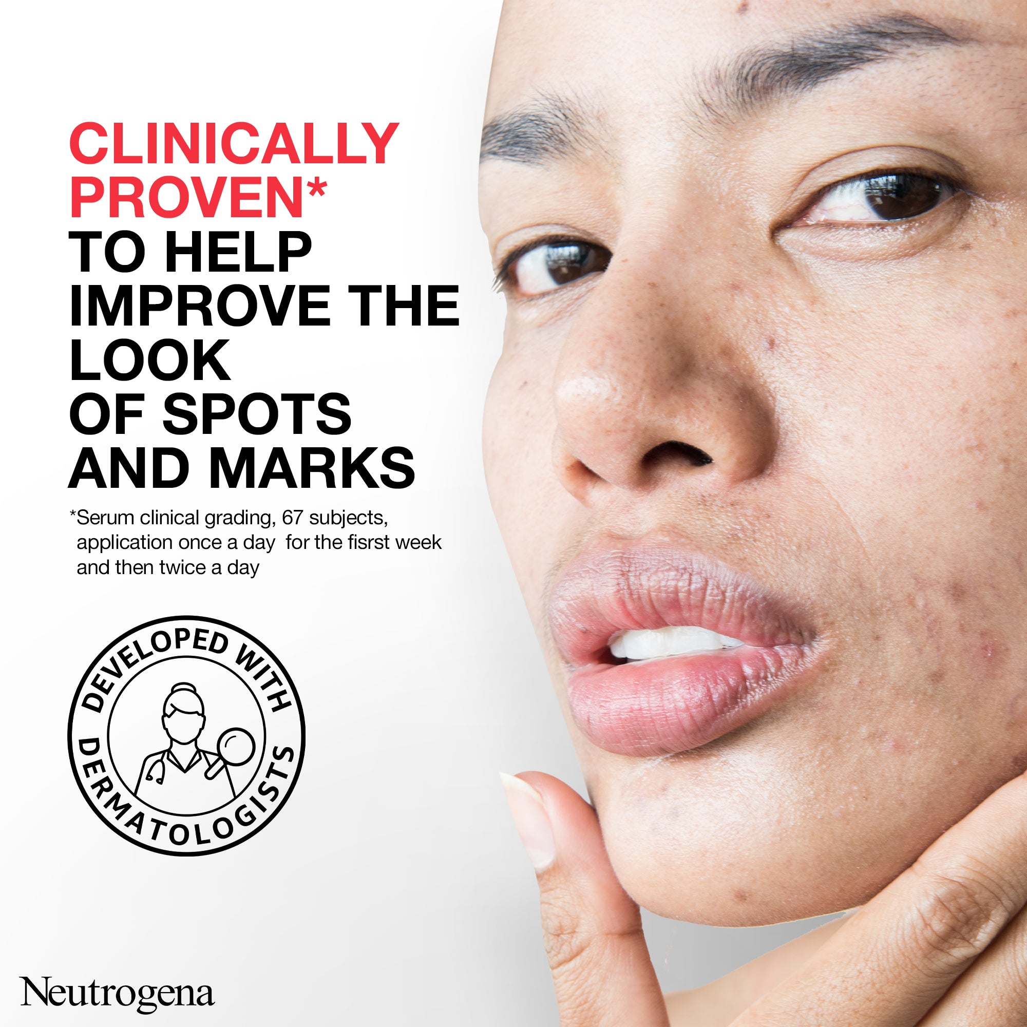 NG Anti-Boutons+ Serum 