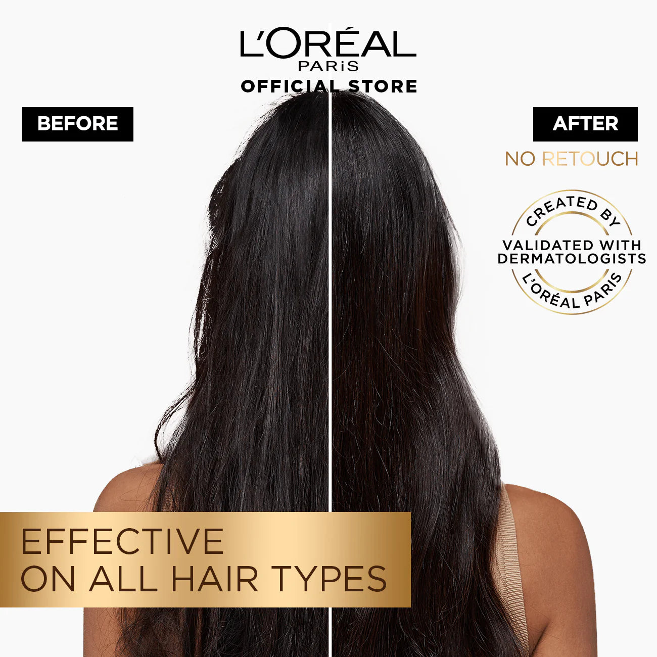 L'Oreal Paris - Elvive Fall Resist Anti Hair-Fall Serum with Aminexil