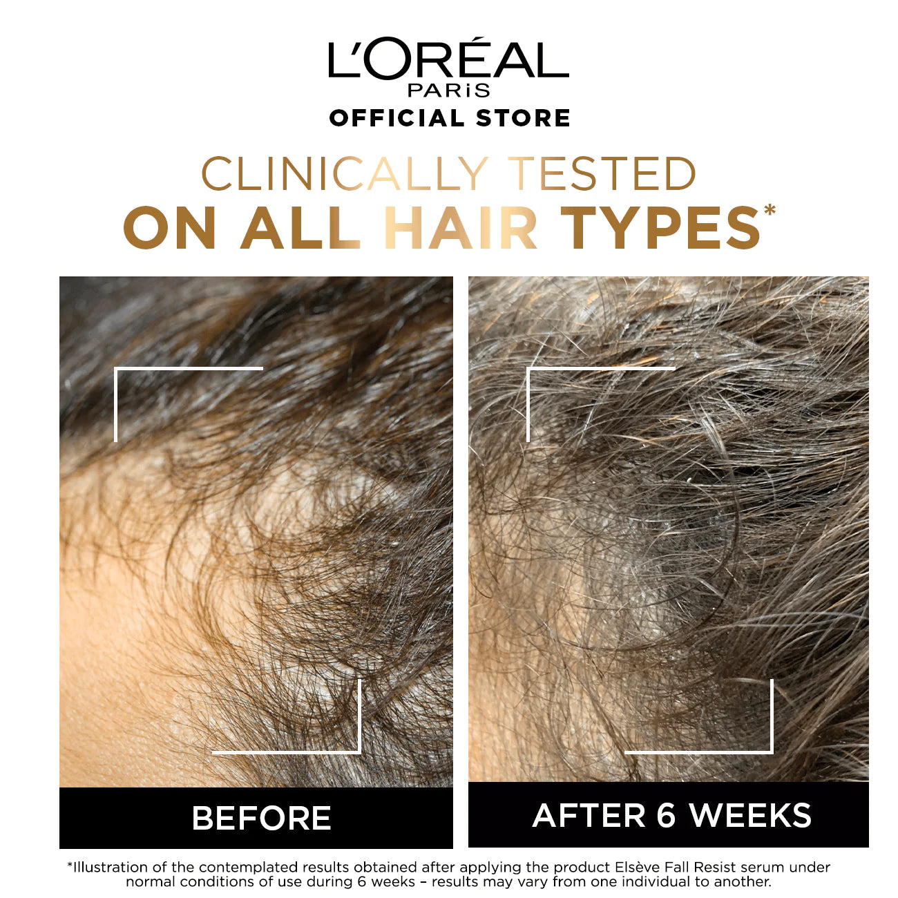 L'Oreal Paris - Elvive Fall Resist Anti Hair-Fall Serum with Aminexil